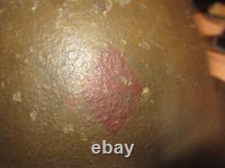 Original U. S. WWI 5th Infantry Red Diamond Division M1917 Doughboy Helmet